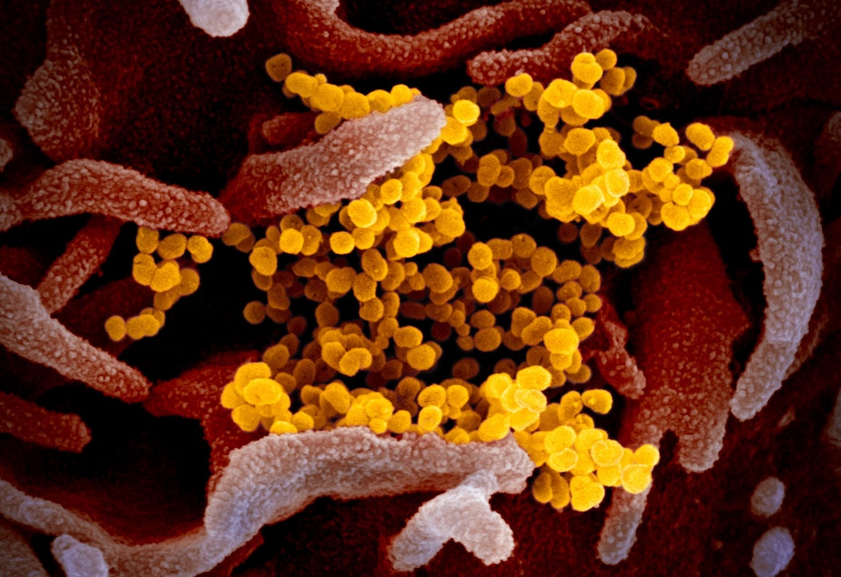 caption: This colorized transmission electron micrograph image shows SARS-CoV-2,  the virus that causes COVID-19. This specimen was isolated from a patient in the U.S. Particles of the virus (yellow) are emerging from the surface of cells cultured in the lab (pink). The spikes on the outer edge of the virus particles give coronaviruses their name: Corona is Latin for "crown."