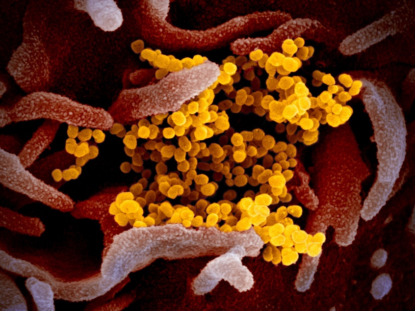 caption: This colorized transmission electron micrograph image shows SARS-CoV-2,  the virus that causes COVID-19. This specimen was isolated from a patient in the U.S. Particles of the virus (yellow) are emerging from the surface of cells cultured in the lab (pink). The spikes on the outer edge of the virus particles give coronaviruses their name: Corona is Latin for "crown."
