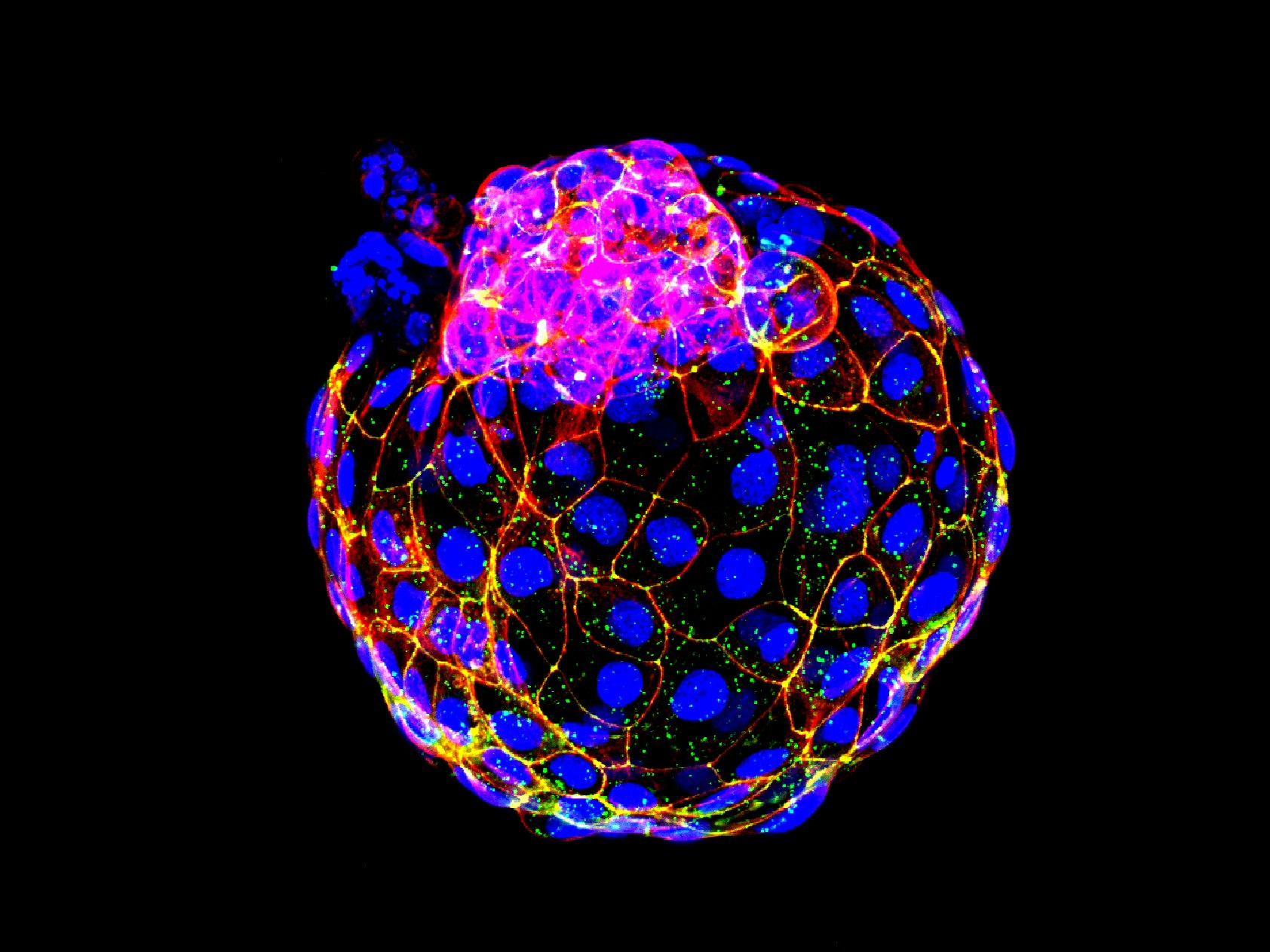 KUOW - Scientists Create Living Entities In The Lab That Closely Resemble Human Embryos - Vimarsana News