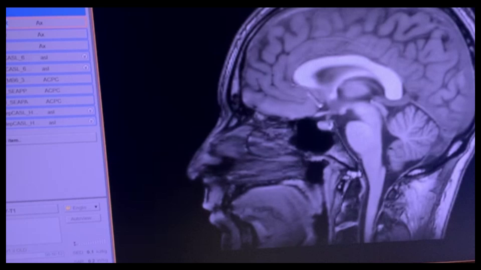 KUOW - A device to 'cleanse' the brain and enhance sleep: UW