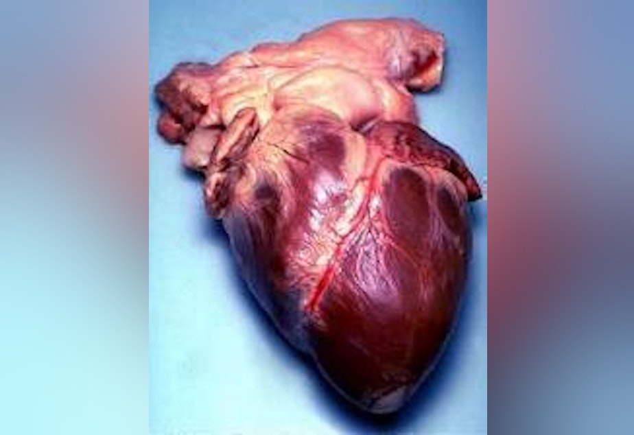 caption: A human heart.