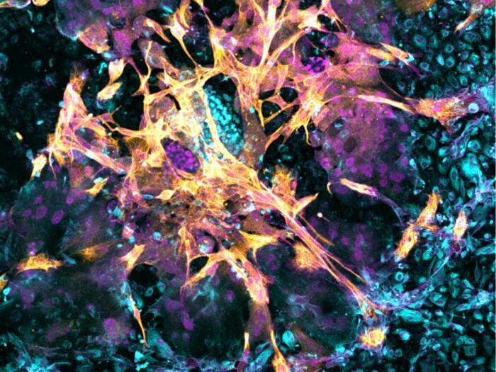 caption: Microscopy image of a day 14 human embryo that has implanted in the new artificial womb.