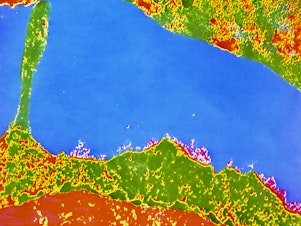 caption: This colorized transmission electron micrograph of a human white blood cell (bottom) shows the HLA antigen — the uneven red areas on the cell's exterior surface. A variant of the HLA gene could play a role in warding off COVID symptoms.