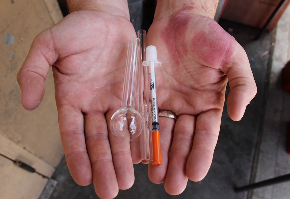 caption: Shilo Murphy holds drug paraphernalia that his needle exchange supplies to users on an alley off the Ave.