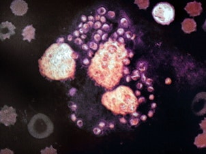 caption: Dozens of <em>Leishmania</em> parasites (purple) surround 3 white blood cells (orange) in this image magnified 1,000 times.