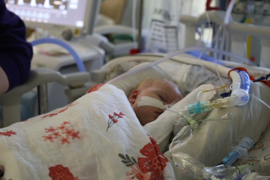 caption: Elizabeth Hutt has an Aspergillus infection after multiple surgeries at Seattle Children's Hospital for a congenital heart defect.