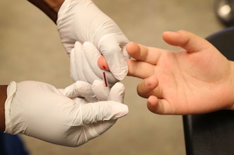 caption: More testing for HIV infection is one of the steps needed to halt the spread of the virus.