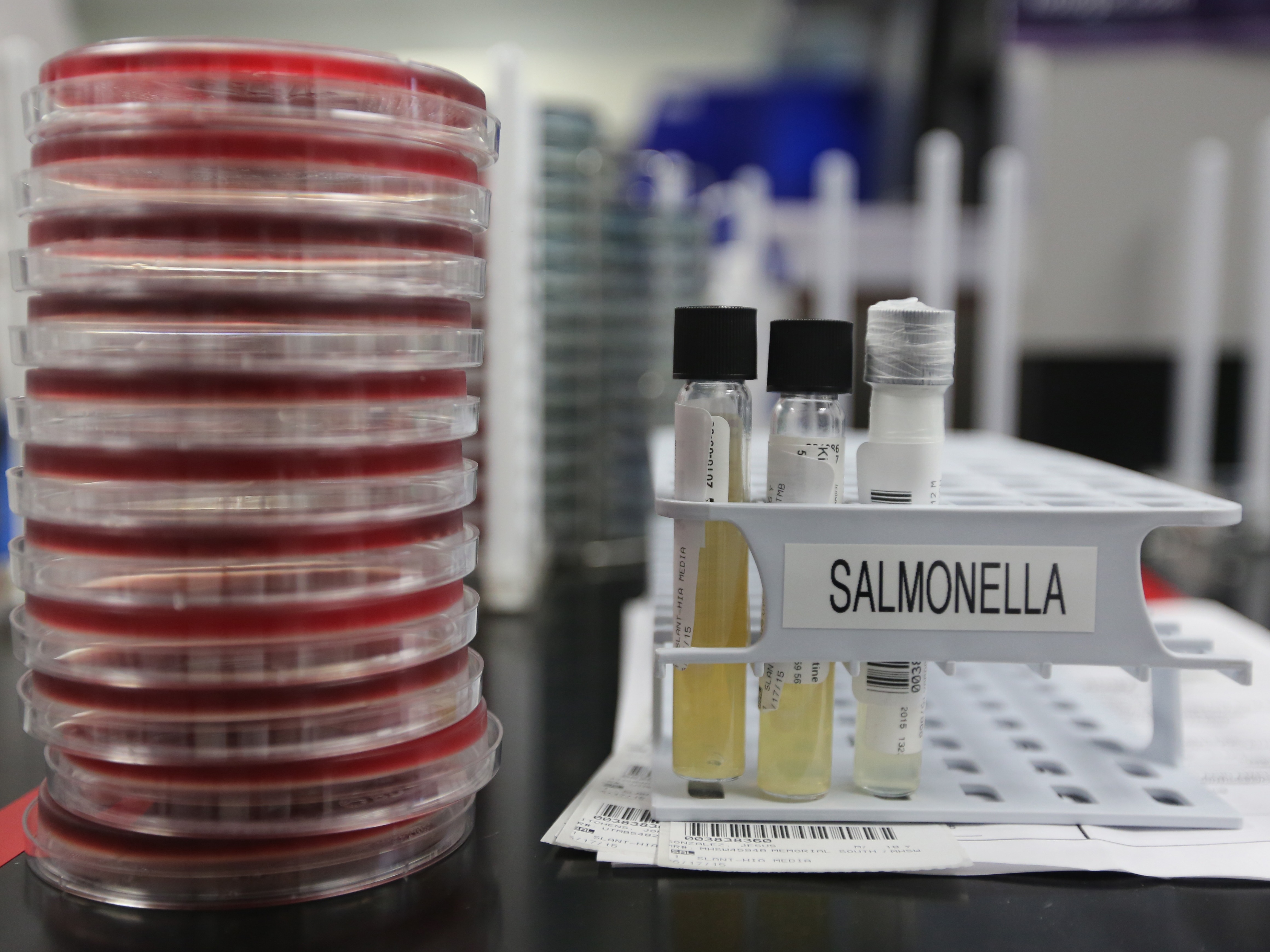 caption: Agar plates with salmonella cultures ready for testing in the Medical Microbiology at the Houston Health and Human Services Department on June 18, 2015, in Houston.