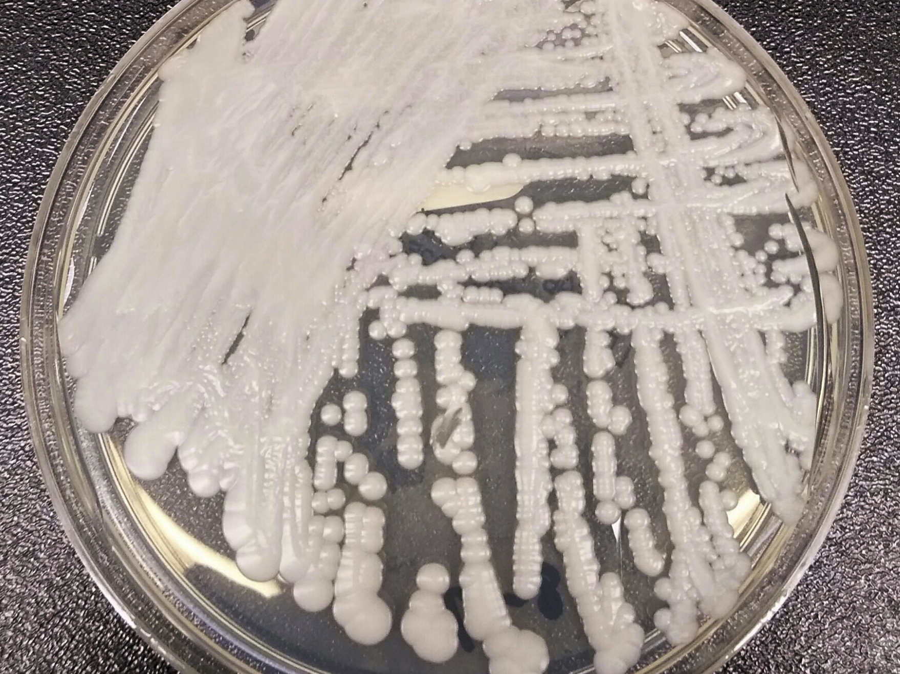 caption: This is a strain of Candida auris cultured in a petri dish at a laboratory at the Centers for Disease Control and Prevention. It's a form of yeast that can harm humans — and is resistant to the most common antifungal drugs.