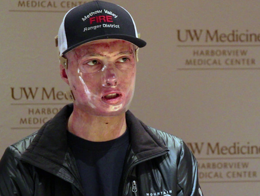 caption: Daniel Lyon speaks at a news conference on Harborview Medical Center on Wednesday, the day he was released after more than four months in the hospital recovering from burns suffered in the Twisp River wildfire.