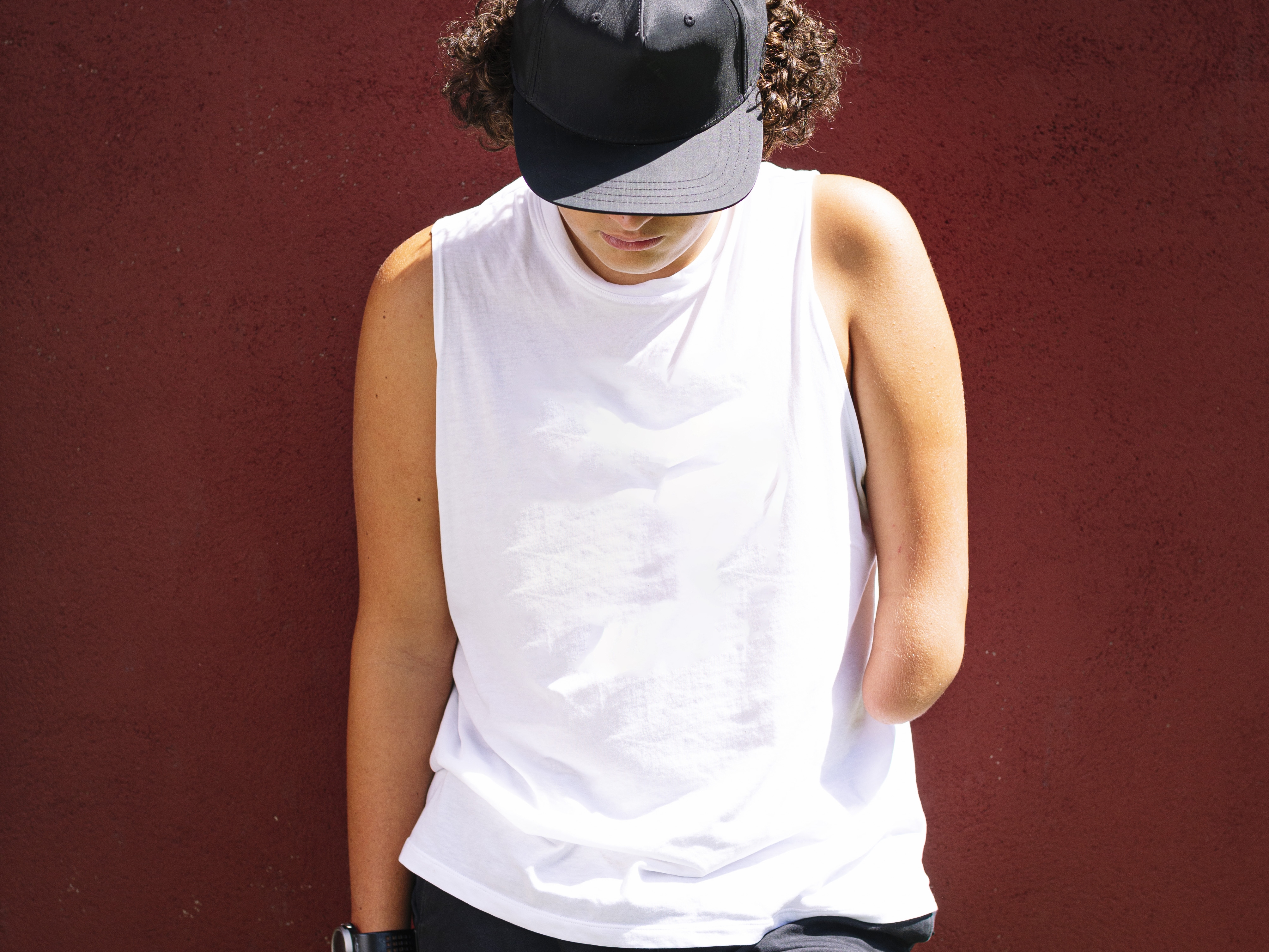 caption: A new study finds that the brain does not appear to significantly rewire its map of the body after an amputation.