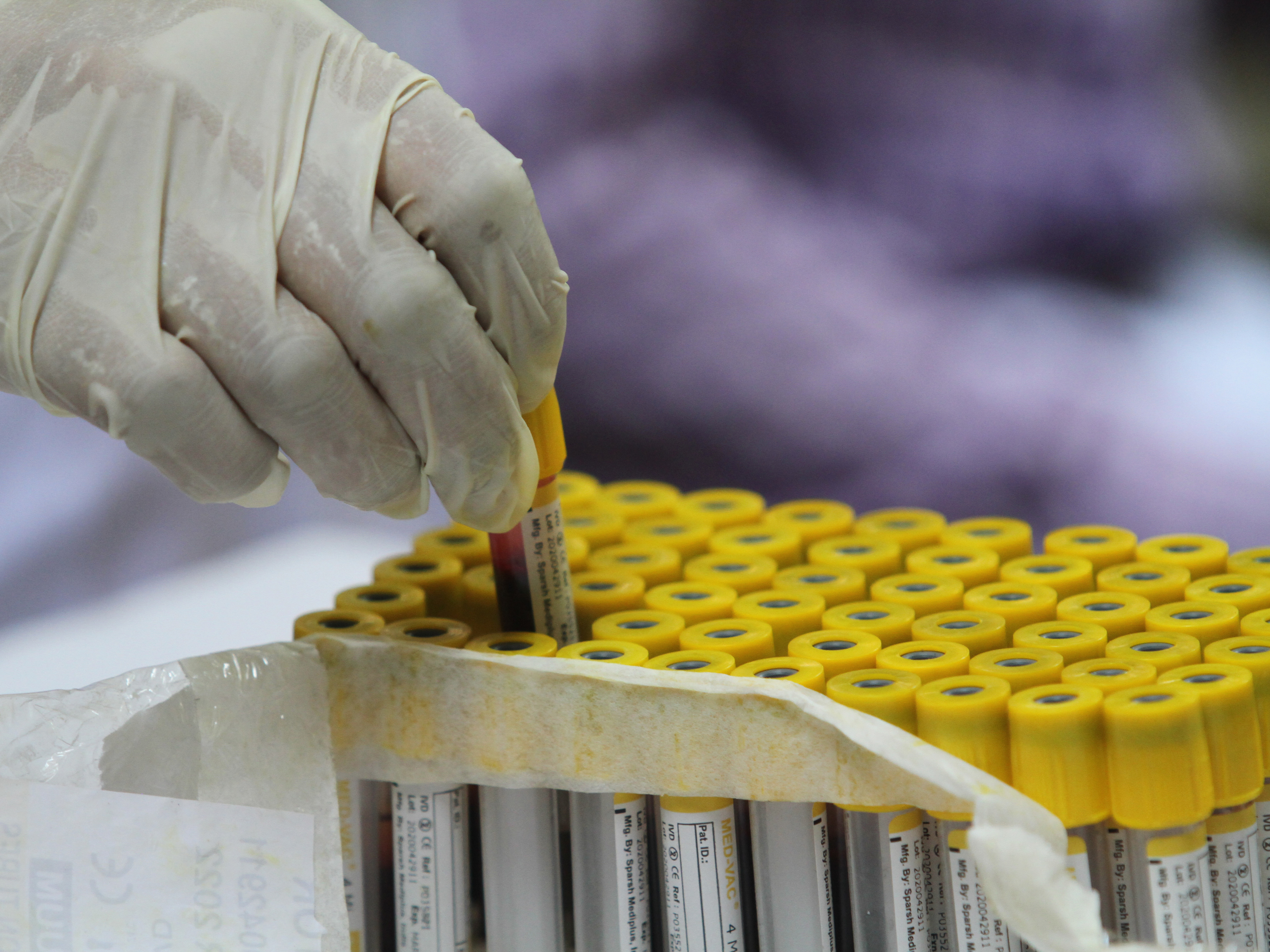 caption: Testing your antibody levels to get a sense of your COVID-19 protection may be tempting, especially as you wait for a booster shot. But scientists say these widely available tests can't tell you the full story, at least not yet.