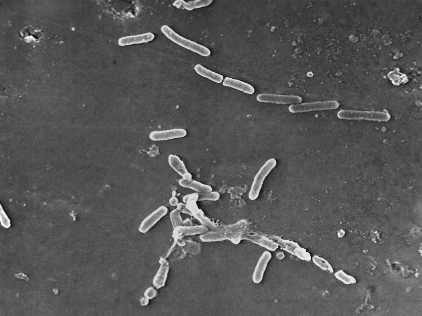 caption: Pseudomonas aeruginosa bacteria as seen under a microscope. The Centers for Disease Control and Prevention says 68 people have become infected with a drug-resistant strain of the bacteria, with many infections linked to the use of contaminated eye drops.