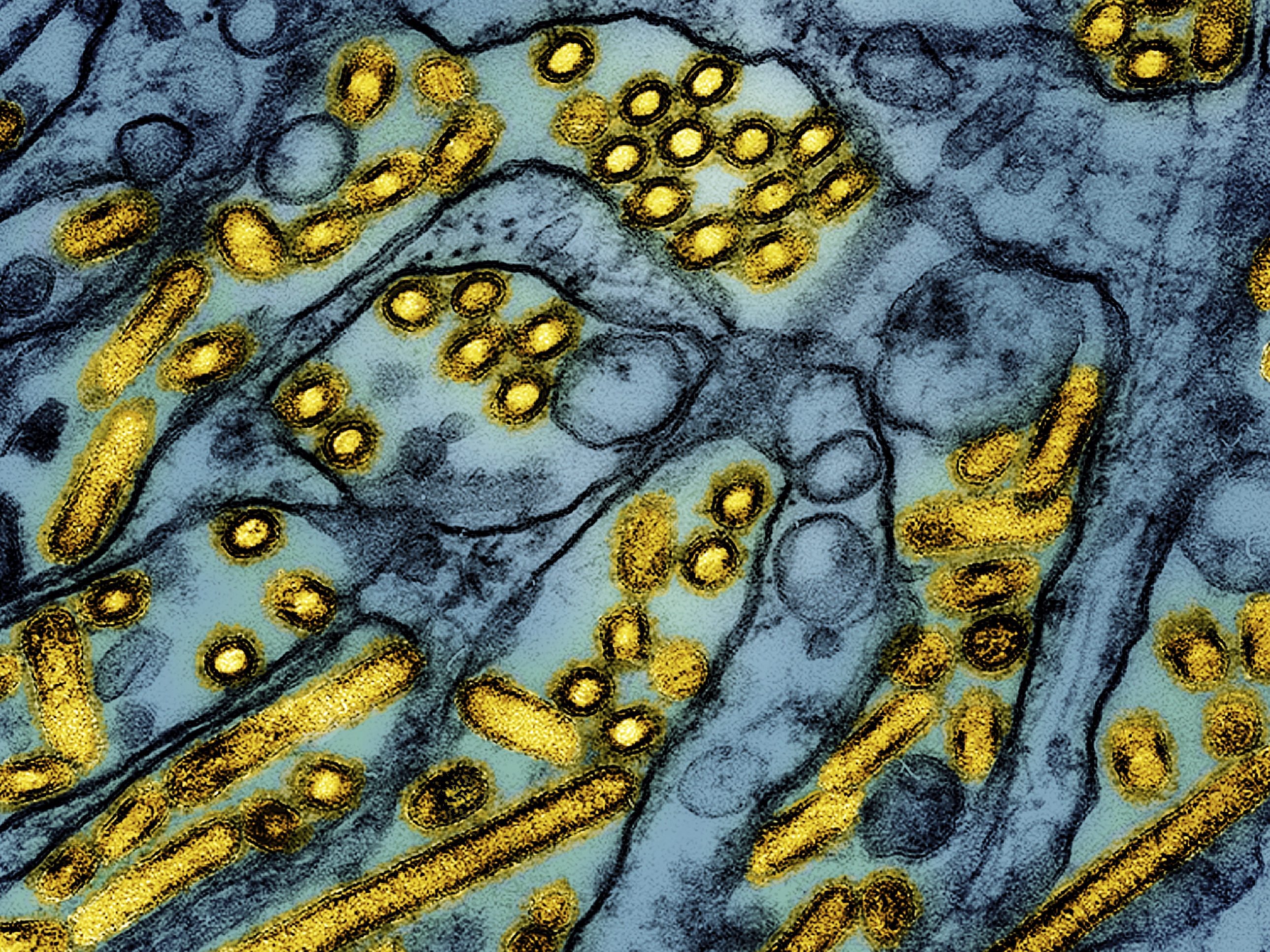 caption: This colorized electron microscope image released by the National Institute of Allergy and Infectious Diseases in March shows avian influenza A H5N1 virus particles (in yellow). The CDC says the first severe case of bird flu detected in a human during the current U.S. outbreak.