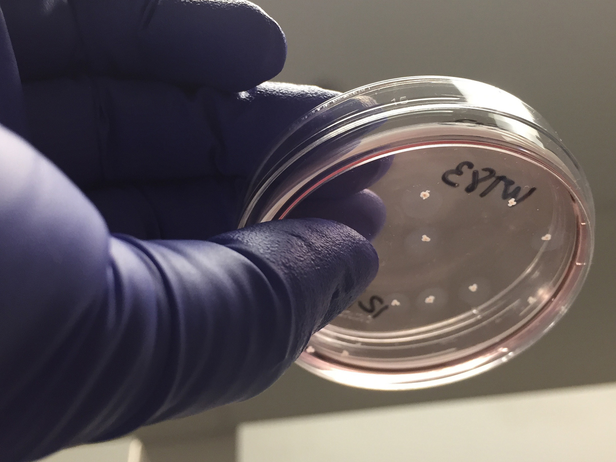 caption: Scientists say pea-size organoids of human brain tissue may offer a way to study the biological beginnings of a wide range of brain conditions, including autism, bipolar disorder and schizophrenia.