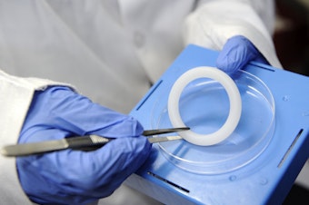 caption: This is the vaginal ring that releases the antiretroviral drug dapivirine to ward off HIV infection. The ring is now going into wider distribution in sub-Saharan Africa, where girls and young women age 15 to 24 accounted for more than 77% of new HIV infections in 2022, according to UNAIDS.