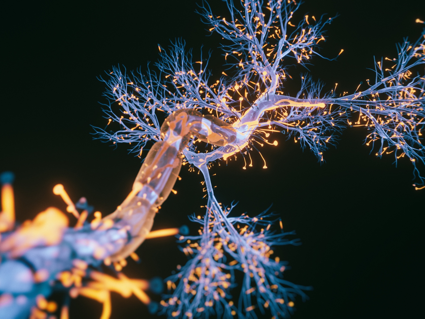 caption: Scientists have found one type of neuron is affected early in Alzheimer's.