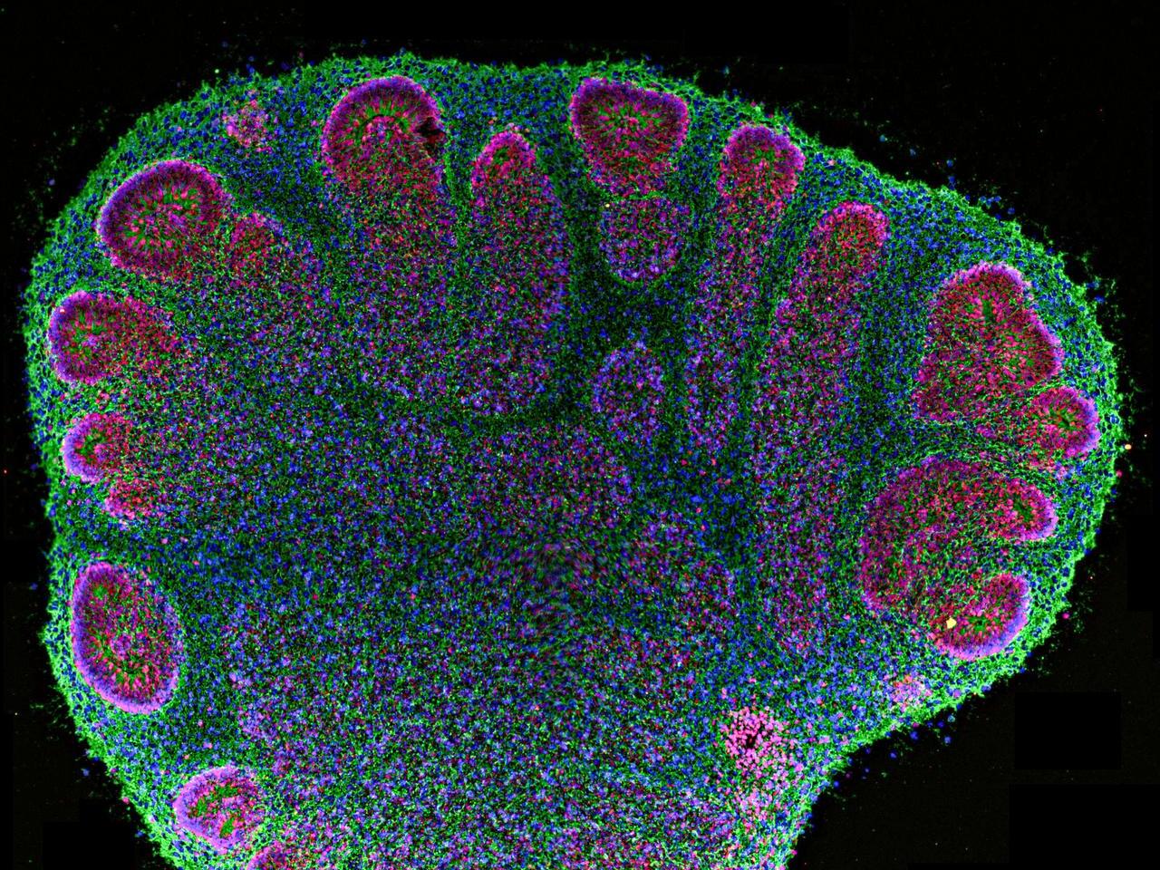 caption: Cross-section of a two-month old cerebral organoid observed under a fluorescence microscope.