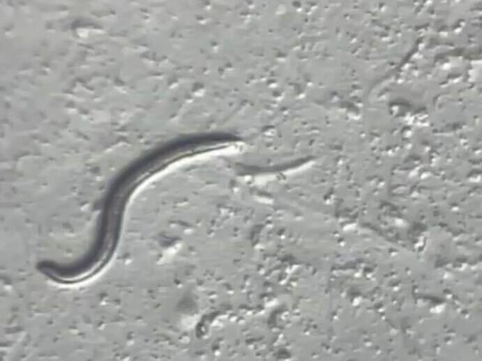 caption: A <em>Panagrolaimus kolymaensis </em>nematode is seen under the microscope at the University of Cologne's worm lab in Germany.