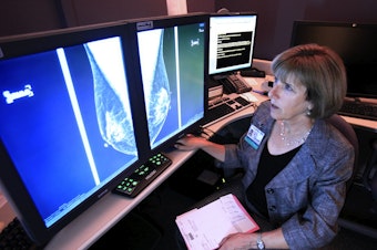 caption: ln this photo taken Wednesday Sept. 14, 2011, Dr. Karen Lindsfor, a professor of radiology and chief of breast imaging at the University of California, Davis Medical Center, examines the mammogram of a patient with heterogeneously dense breast tissue. Lindfors is among those doctors who say there is insufficient evidence to support the idea that additional screenings would detect cancers earlier. 