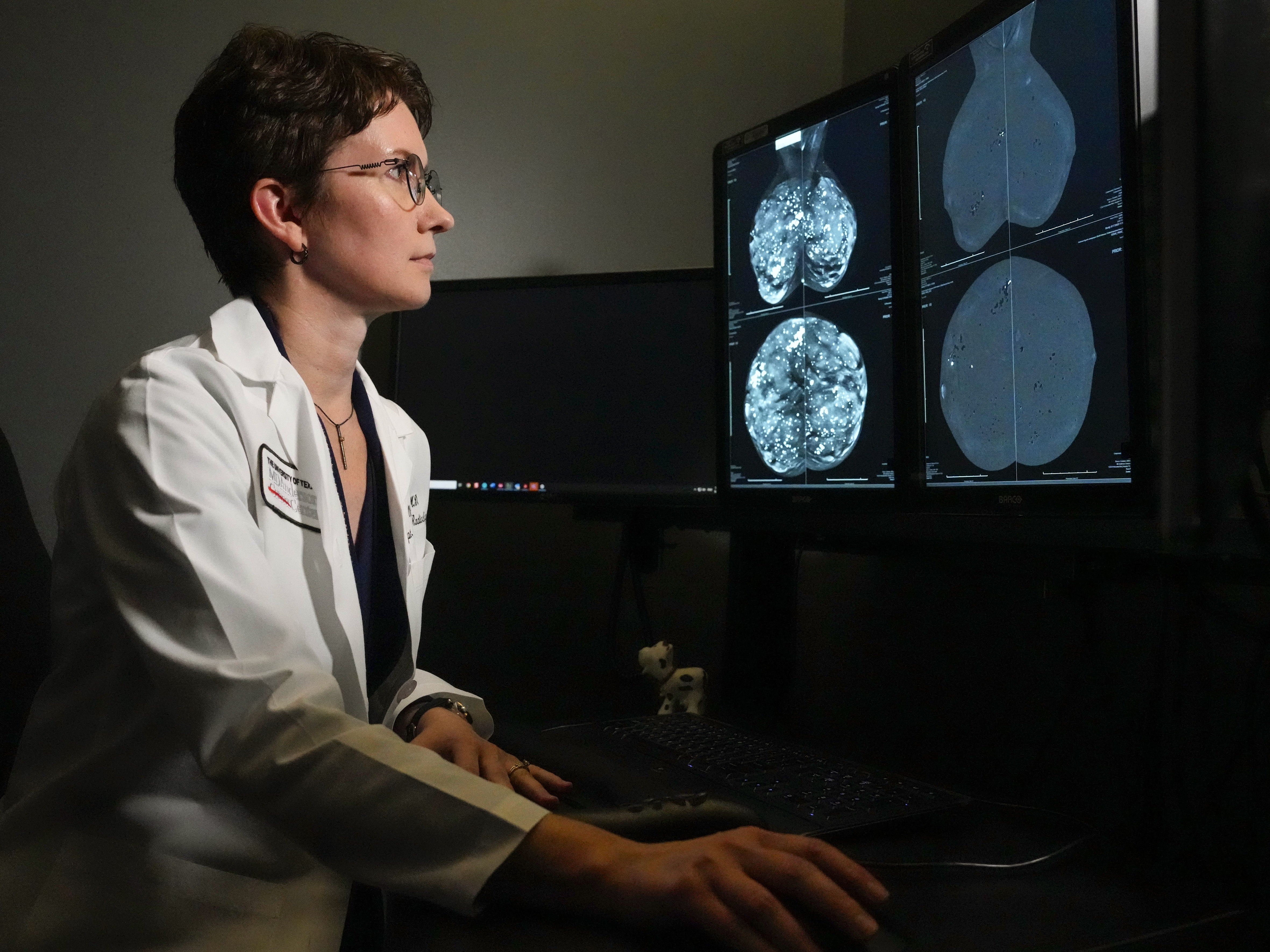 caption: Dr. Olena Weaver of MD Anderson Cancer Center in Houston looks at mammogram imagery. The regular mammogram on the left shows a woman with dense breast tissue; on the right is a <a href="https://www.mdanderson.org/cancerwise/what-is-a-contrast-enhanced-mammogram.h00-159701490.html">contrast-enhanced mammogram</a>.