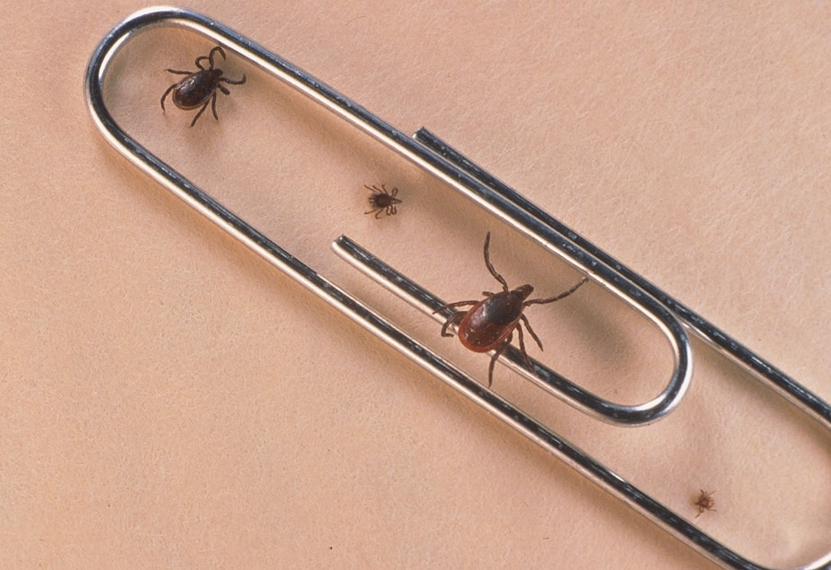 caption: Cases of babesiosis, a tick-borne illness, are on the rise throughout the northeast, according to a new report from the Centers for Disease Control and Prevention.