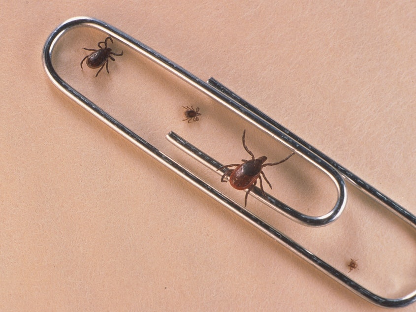 caption: Cases of babesiosis, a tick-borne illness, are on the rise throughout the northeast, according to a new report from the Centers for Disease Control and Prevention.