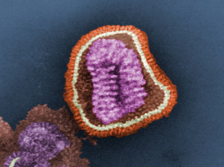 caption: This negative-stained transmission electron micrograph (TEM) depicts the ultrastructural details of an influenza virus particle, or "virion". A member of the taxonomic family <em>Orthomyxoviridae</em>, the influenza virus is a single-stranded RNA organism.