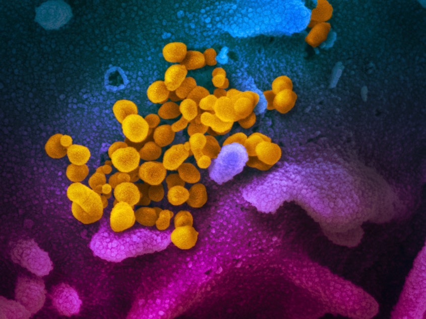 caption: COVID-19 coronavirus is seen in yellow, emerging from cells (in blue and pink) cultured in the lab. This image is from a scanning electron microscope.