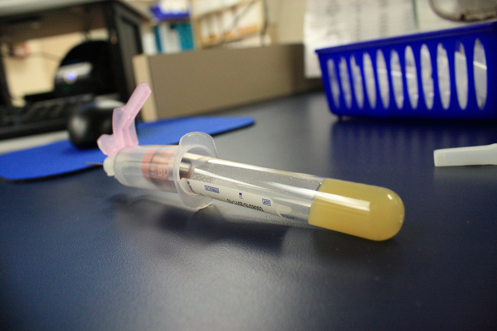 caption: An empty HIV test vial.