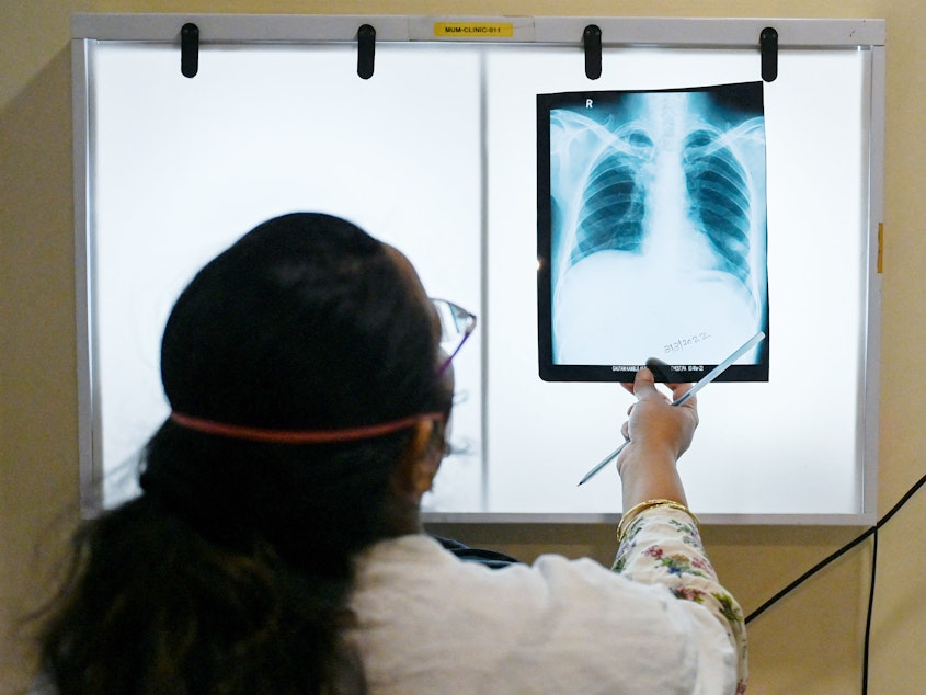 caption: A doctor checks chest x-rays of a tuberculosis patient at a clinic in Mumbai, India, that treats those with drug-resistant strains of the disease. The World Health Organization has called for the eradication of this ancient and deadly infectious disease.