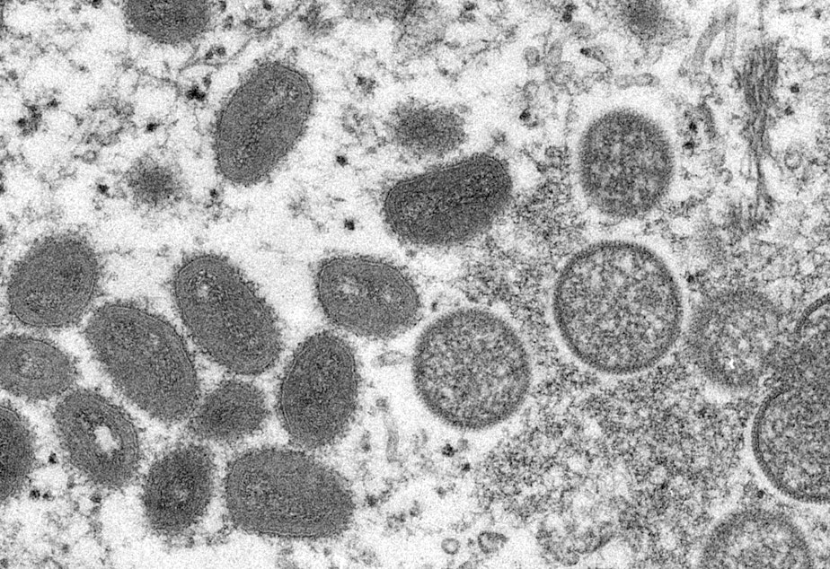 caption: This 2003 electron microscope image made available by the Centers for Disease Control and Prevention shows mature, oval-shaped monkeypox virions, left, and spherical immature virions, right, obtained from a sample of human skin associated with the 2003 prairie dog outbreak.
