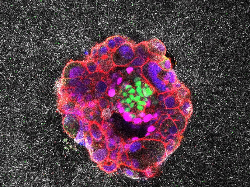 caption: A nine-day-old human embryo seen through a microscope.