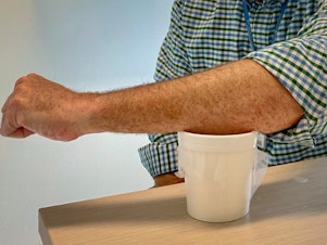 caption: Sean Murphy, lead author of a new malaria vaccine study, demonstrates how participants got their dose: by placing an arm over a mesh-covered container filled with 200 mosquitoes whose bites delivered genetically modified malaria parasites.