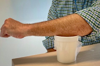 caption: Sean Murphy, lead author of a new malaria vaccine study, demonstrates how participants got their dose: by placing an arm over a mesh-covered container filled with 200 mosquitoes whose bites delivered genetically modified malaria parasites.