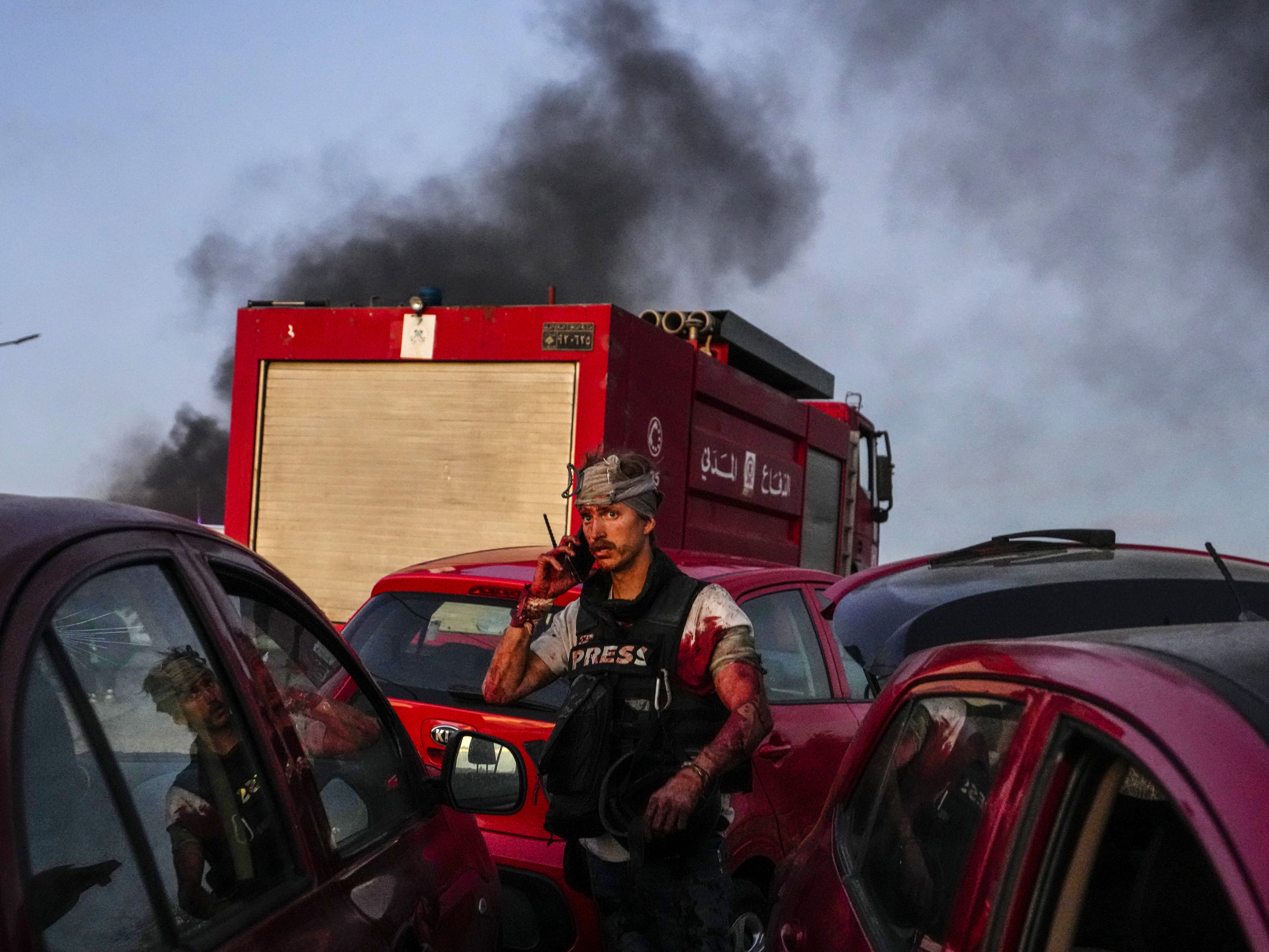 caption: AFP camera operator Dylan Collins speaks on his mobile phone after being injured by Israeli shelling, at Alma al-Shaab border village with Israel, southern Lebanon, on Oct. 13, 2023. An Israeli shell landed in a gathering of international journalists covering clashes on the border in south Lebanon, killing one and leaving six others injured.