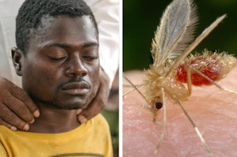 caption: Left to right: Alexis Mukwedi tested positive for sleeping sickness in the Democratic Republic of the Congo. A sandfly, whose bite can spread the parasite causing visceral leishmaniasis, lands on the photographer for a blood meal. A woman in Vietnam receives an eye exam to see if she has trachoma, which can cause blindness. Last year several countries eliminated the threat from this disease.