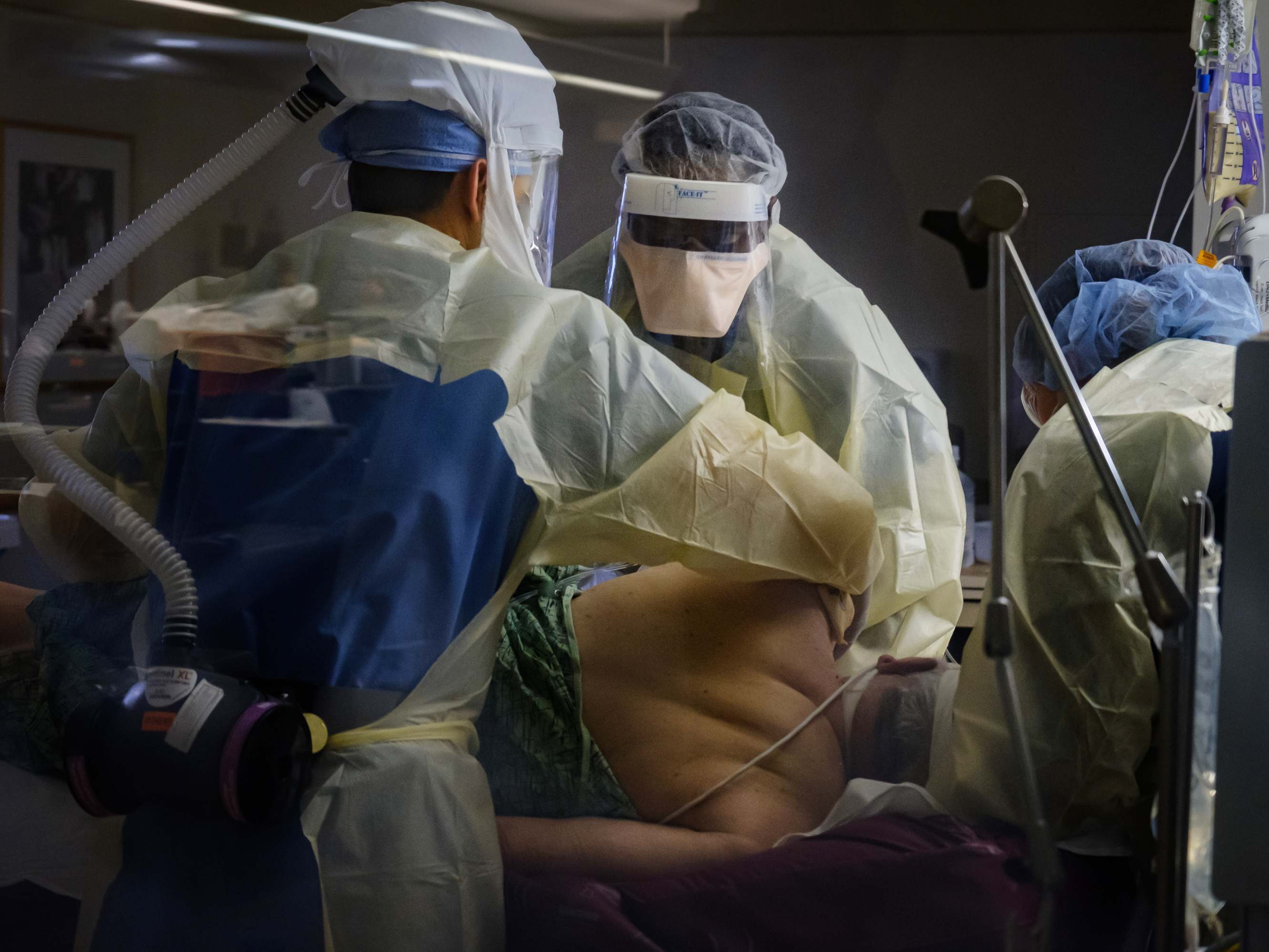 caption: Nurses reposition an intubated COVID-19 patient in a prone position in the intensive care unit at Sharp Chula Vista Medical Center, Chula Vista, Calif., on April 10.
