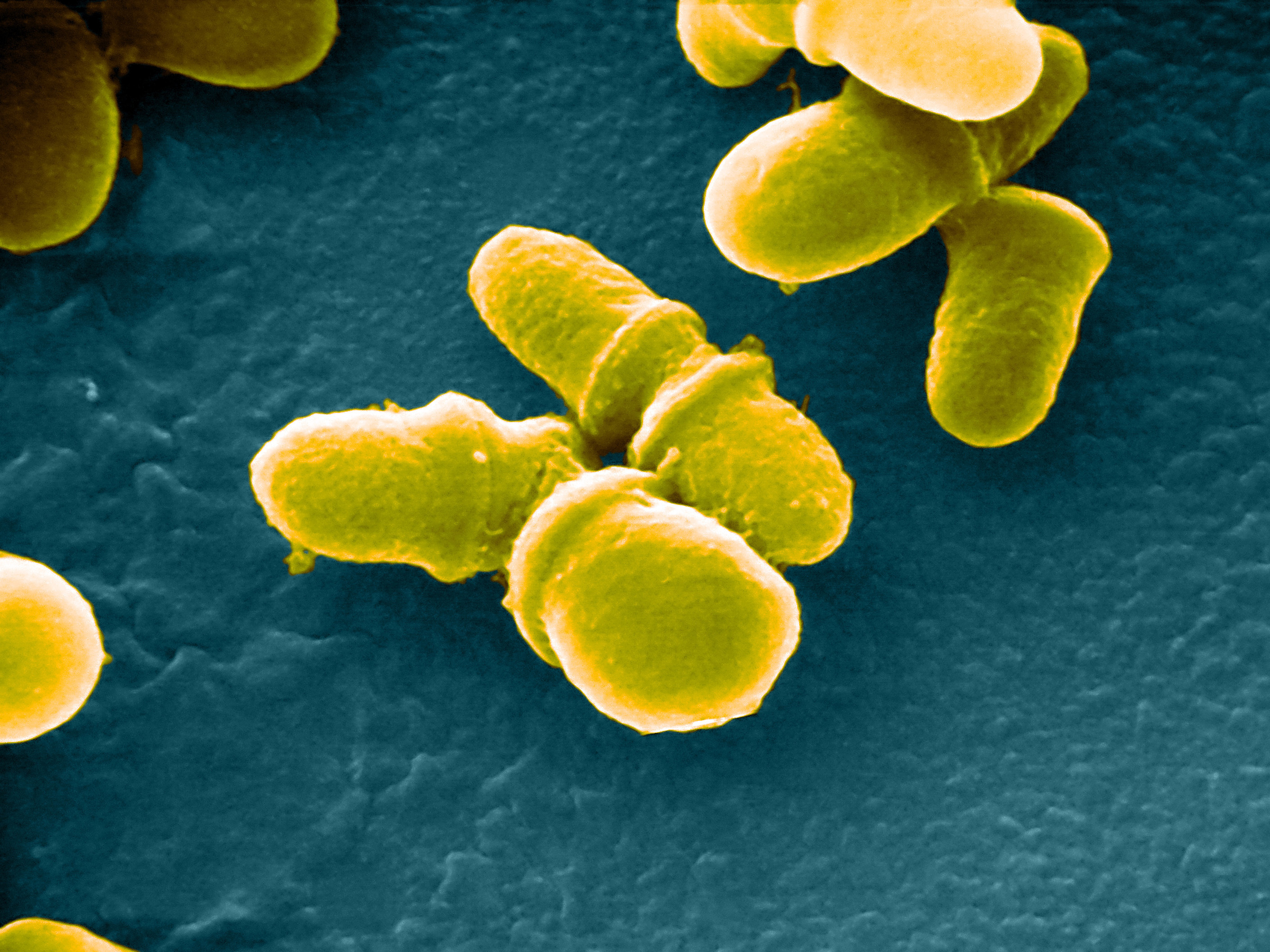 caption: Malassezia is a genus of fungi naturally found on the skin surfaces of many animals, including humans. The researchers found it in urban apartments in Manaus, although some strains have been known to cause infections in hospitals.