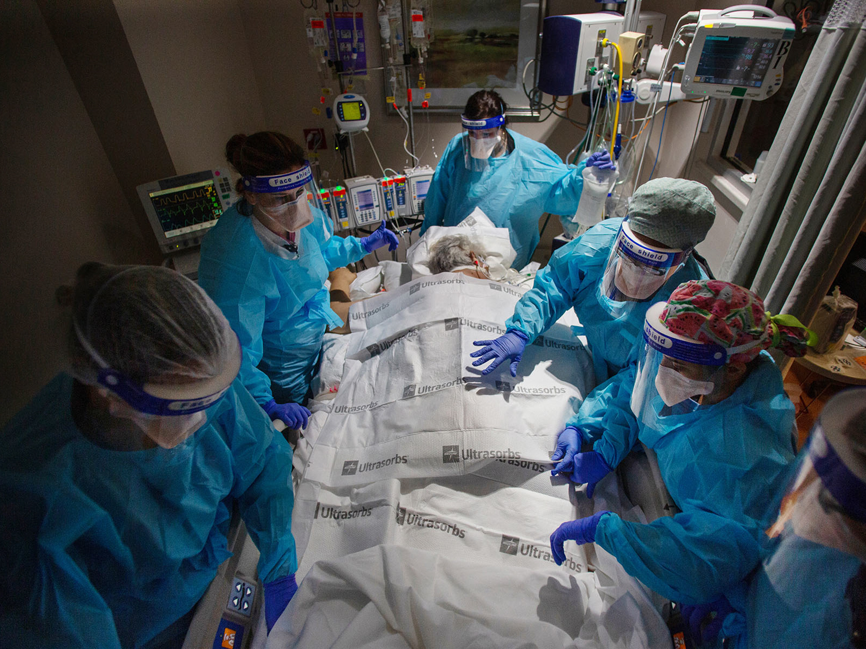 caption: A team of nurses, patient care technicians and a respiratory therapist prepare to return a COVID patient to their back after 24 hours of lying on their stomach. That posture makes it easier to breathe and is a critical part of treatment for COVID patients in hospitals.