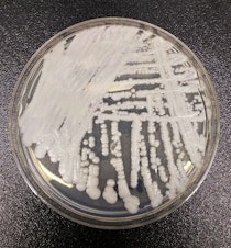 caption: This undated photo made available by the Centers for Disease Control and Prevention shows a strain of Candida auris cultured in a petri dish at a CDC laboratory. 