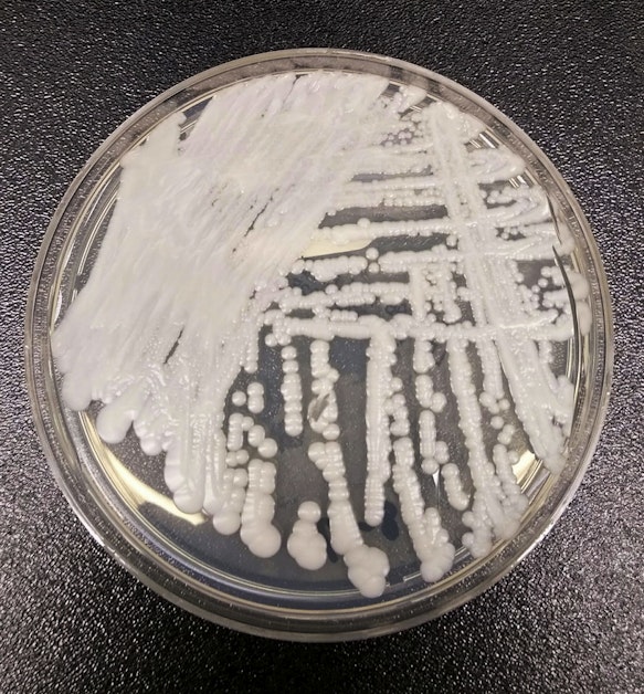 华盛顿州发现四例罕见真菌病例，了解一下相关信息吧