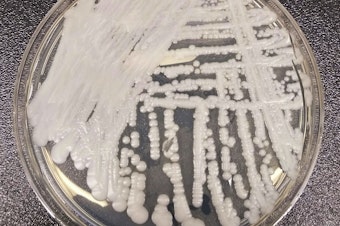 caption: This undated photo made available by the Centers for Disease Control and Prevention shows a strain of Candida auris cultured in a petri dish at a CDC laboratory. 