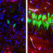 caption: The image on the left shows the brains of pigs that were untreated for 10 hours after death, with neurons appearing as green, astrocytes as red and cell nuclei as blue. The image on the right shows cells in the same area of brains that, four hours after death, were hooked up to a system that the Yale University researchers call Brain<em>Ex</em>.
