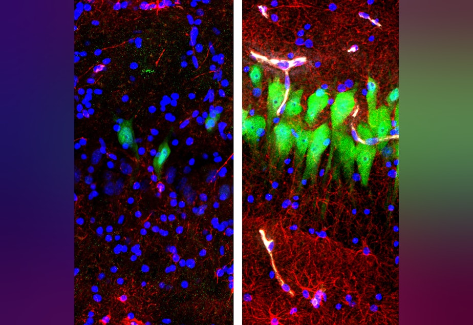 caption: The image on the left shows the brains of pigs that were untreated for 10 hours after death, with neurons appearing as green, astrocytes as red and cell nuclei as blue. The image on the right shows cells in the same area of brains that, four hours after death, were hooked up to a system that the Yale University researchers call Brain<em>Ex</em>.