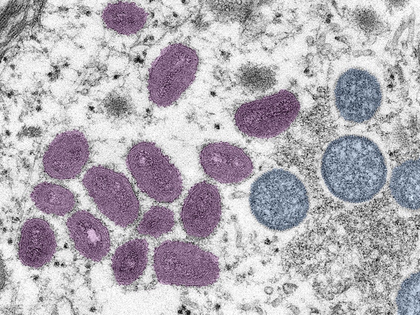 caption: An electron microscopic image of mpox virus particles. The mpox emergency of last summer is over. Was it a passing threat? Or is there reason to believe another global outbreak could happen.
