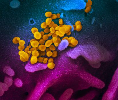 caption: This scanning electron microscope image shows SARS-CoV-2 (yellow)—also known as 2019-nCoV, the virus that causes COVID-19—isolated from a patient in the U.S., emerging from the surface of cells (blue/pink) cultured in the lab.