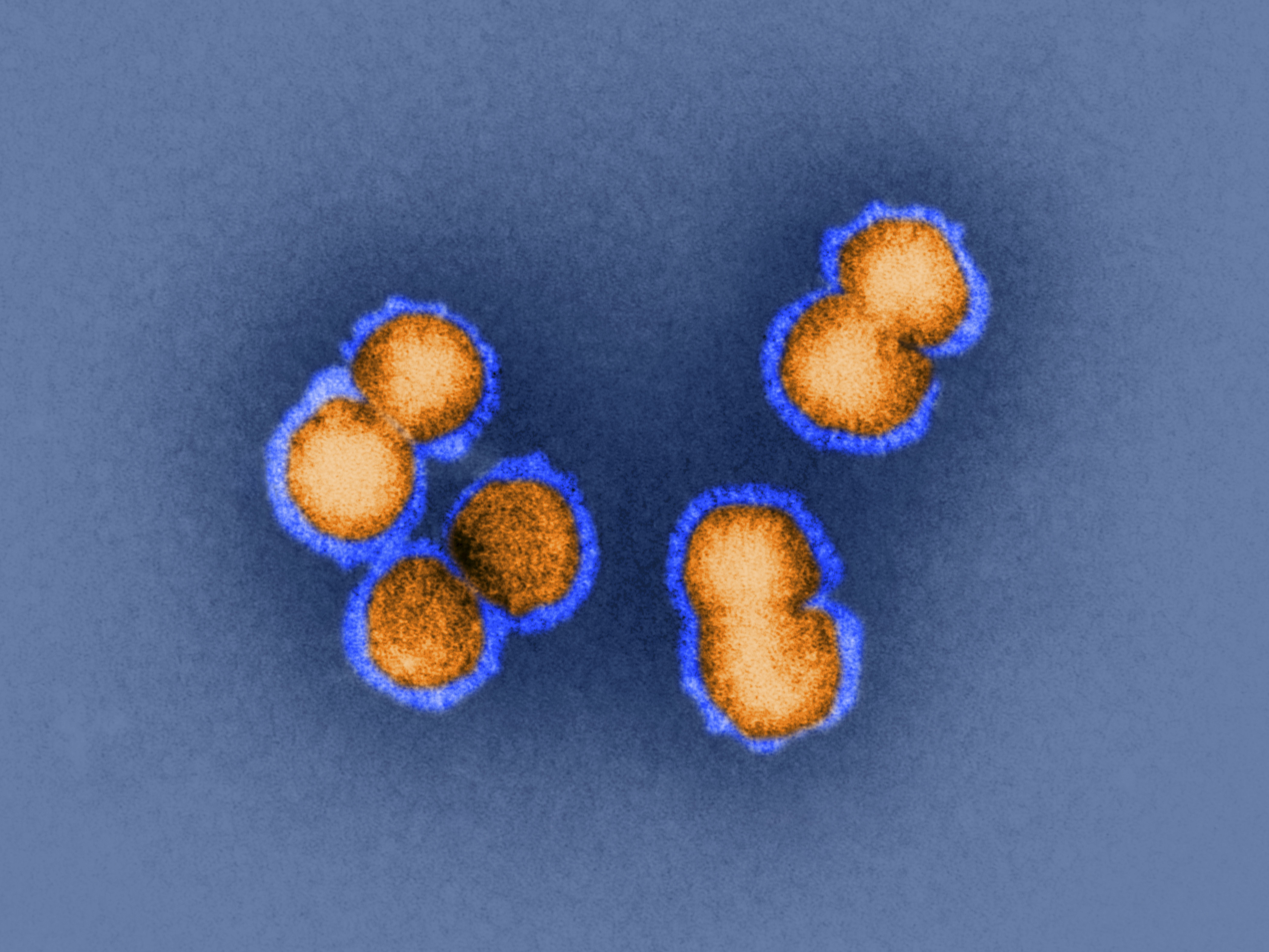 caption: H5N1 bird flu virus is the sort of virus under discussion this week in Bethesda, Md. How animal viruses can acquire the ability to jump into humans and quickly move from person to person is exactly the question that some researchers are trying to answer by manipulating pathogens in the lab.