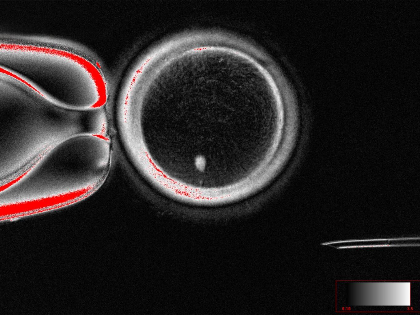 caption: This image shows a human egg after its original DNA has been replaced with DNA from an adult skin cell.