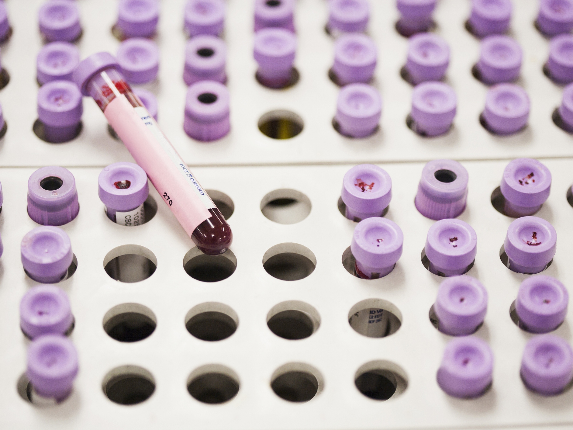 caption: Doctors say patients should get a lipoprotein(a) test along with other screening, in new guidelines for managing cholesterol.